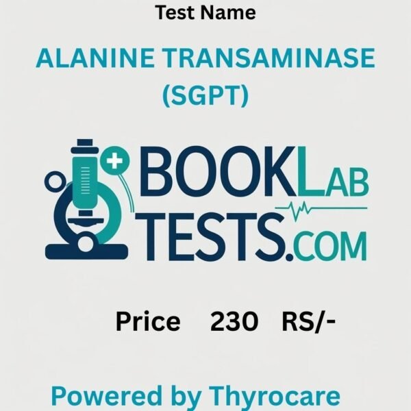ALANINE TRANSAMINASE (SGPT)