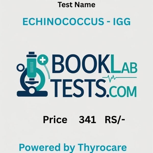 ECHINOCOCCUS - IGG