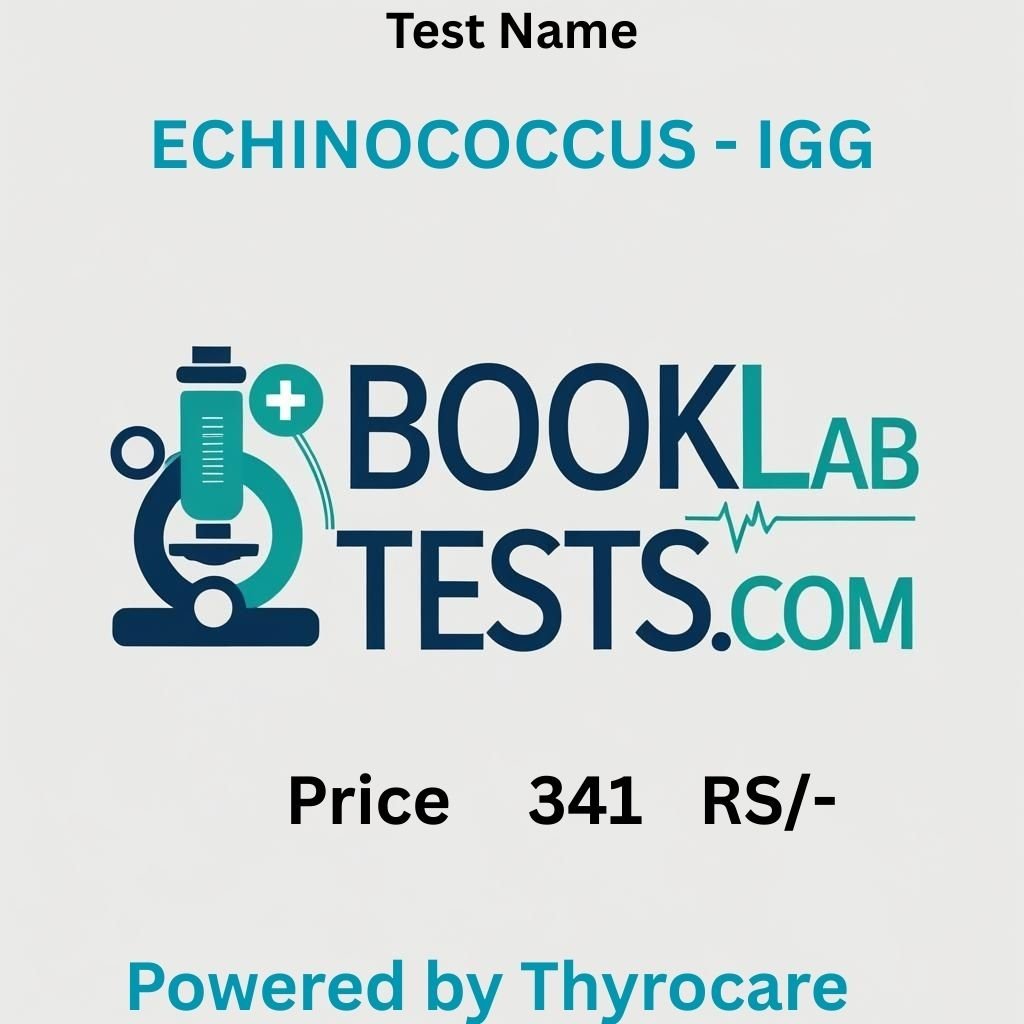 ECHINOCOCCUS - IGG