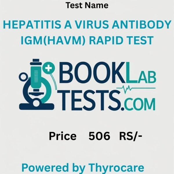 HEPATITIS A VIRUS ANTIBODY IGM(HAVM) RAPID TEST
