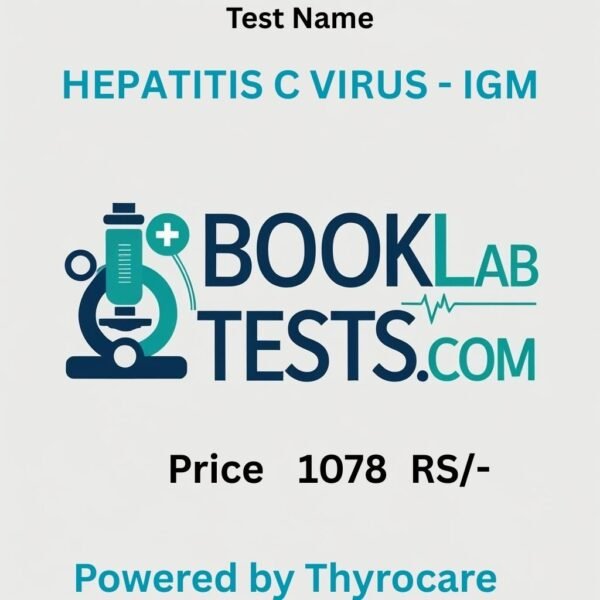 HEPATITIS C VIRUS - IGM