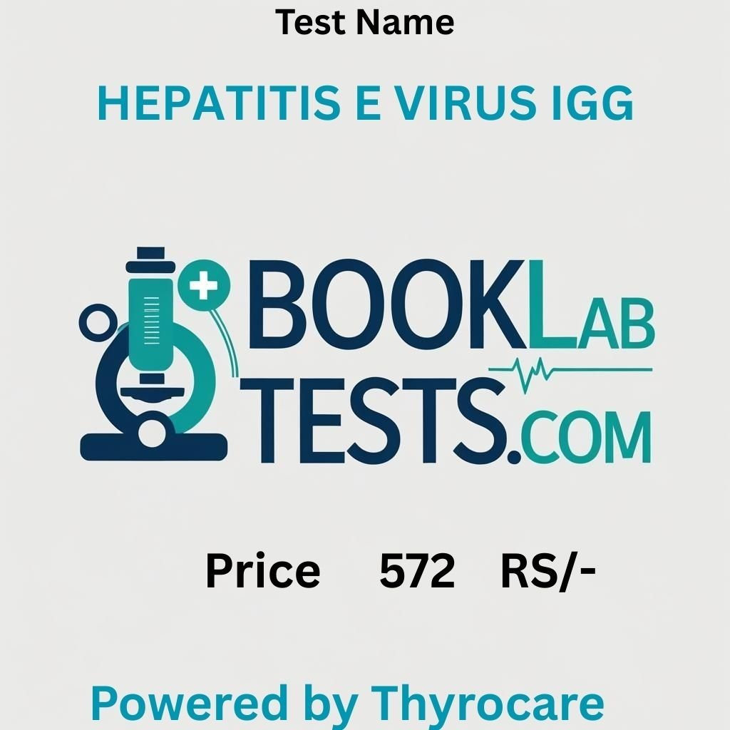 HEPATITIS E VIRUS IGG