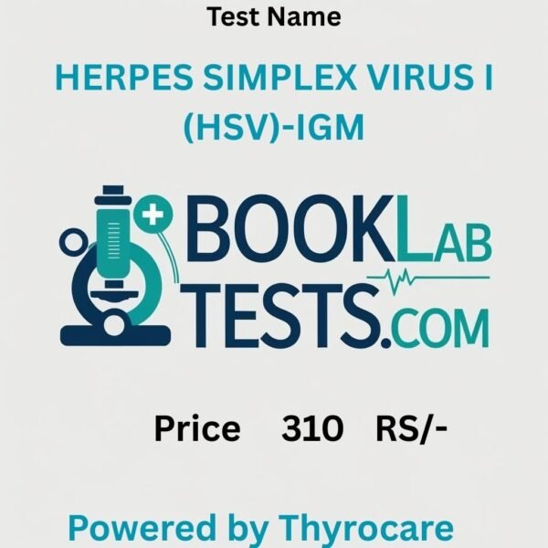 HERPES SIMPLEX VIRUS I (HSV)-IGM