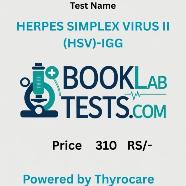 HERPES SIMPLEX VIRUS II (HSV)-IGG