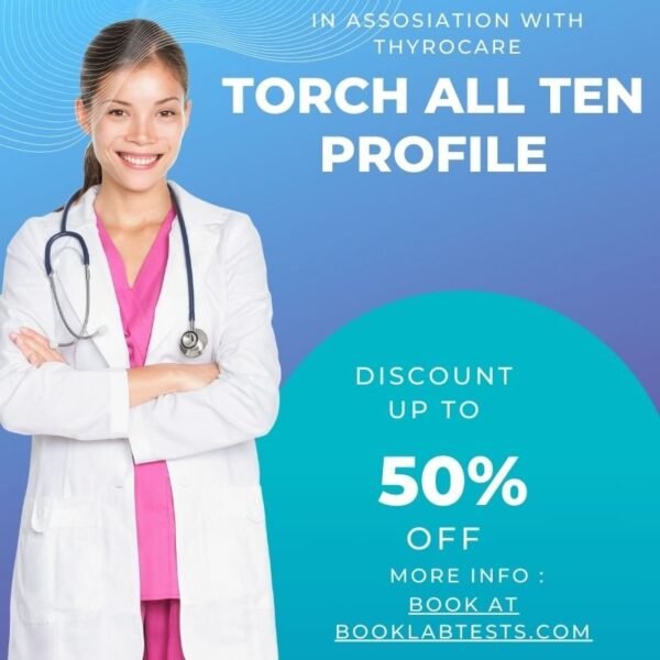 TORCH ALL TEN PROFILE