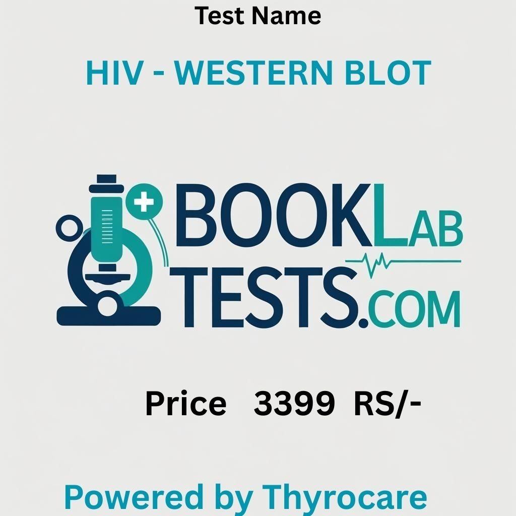 HIV - WESTERN BLOT