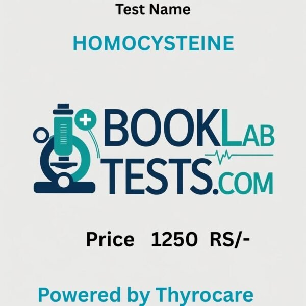 HOMOCYSTEINE