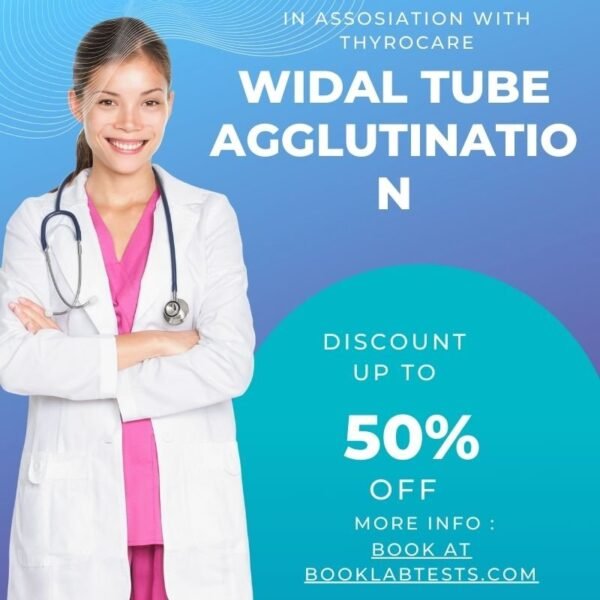 Widal Tube Agglutination Test – Rapid Typhoid Diagnosis with Home Sample Collection