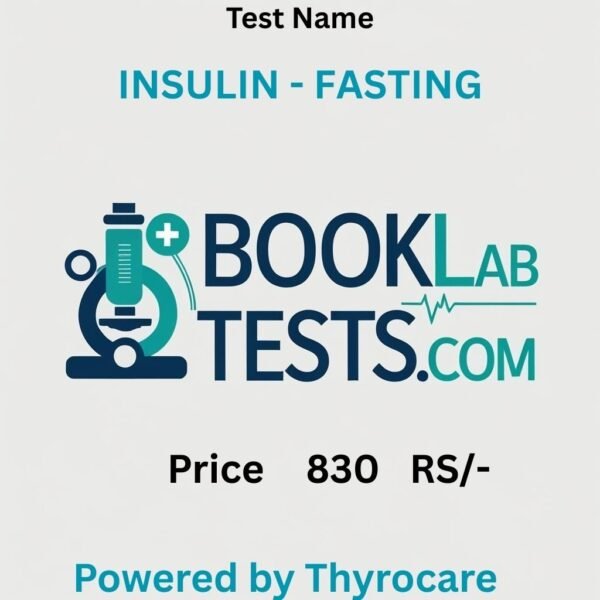 INSULIN - FASTING