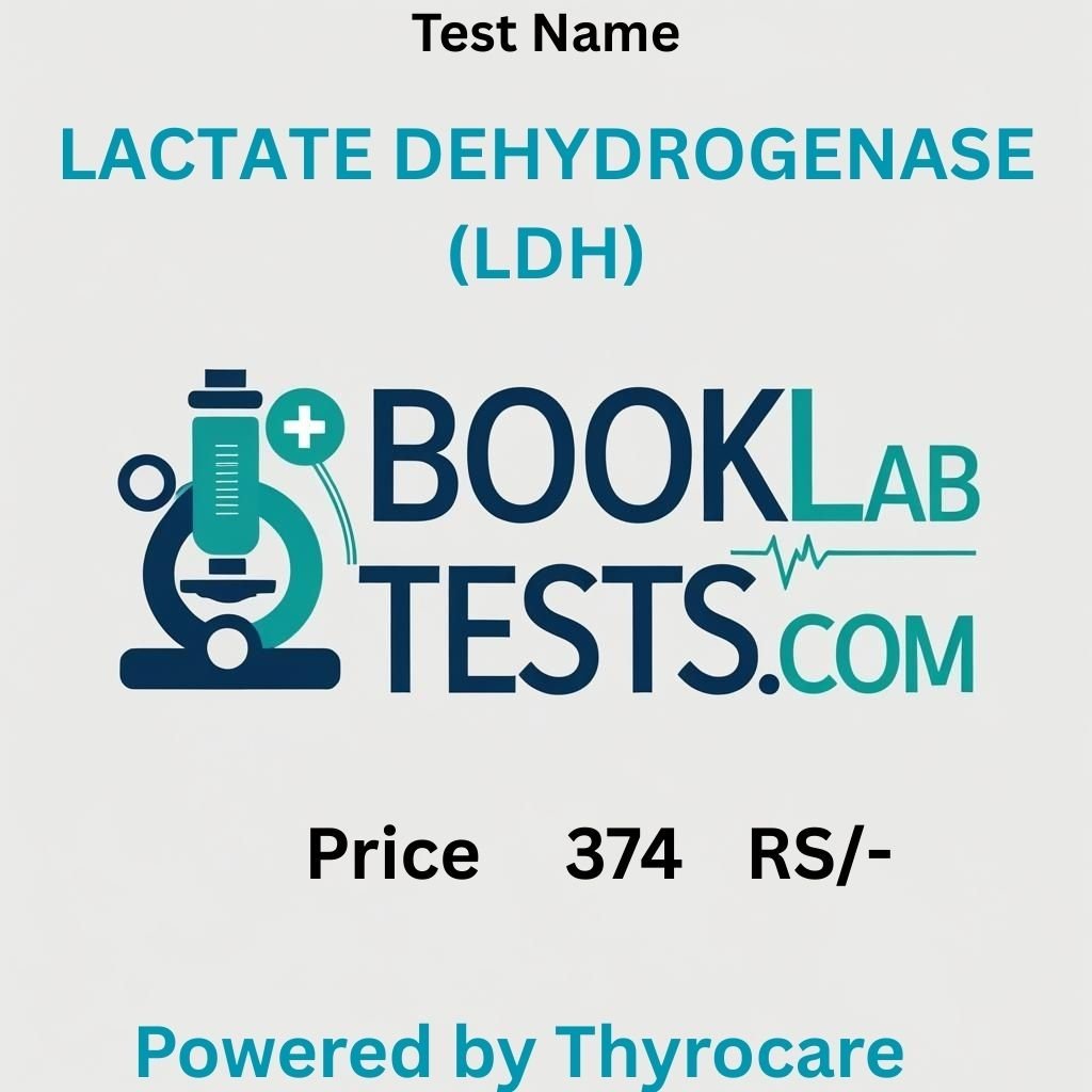 LACTATE DEHYDROGENASE (LDH)