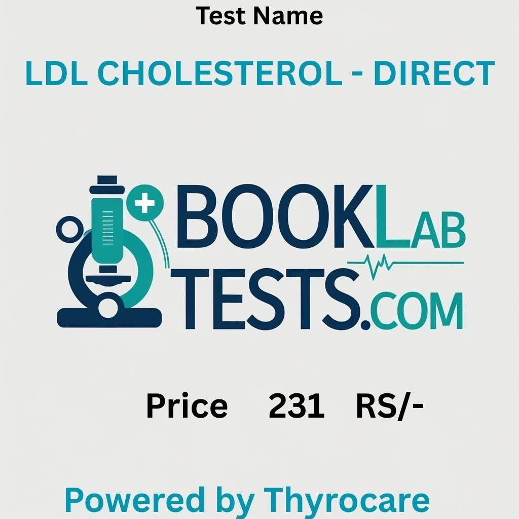 LDL CHOLESTEROL - DIRECT