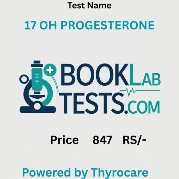 17 OH PROGESTERONE