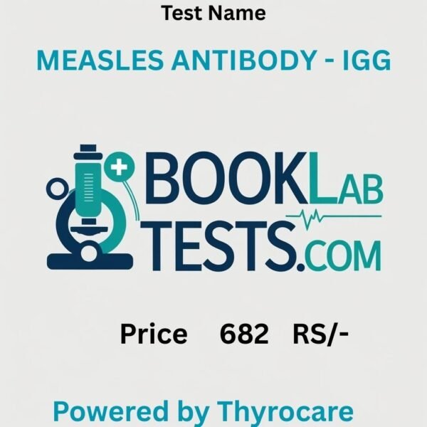 MEASLES ANTIBODY - IGG