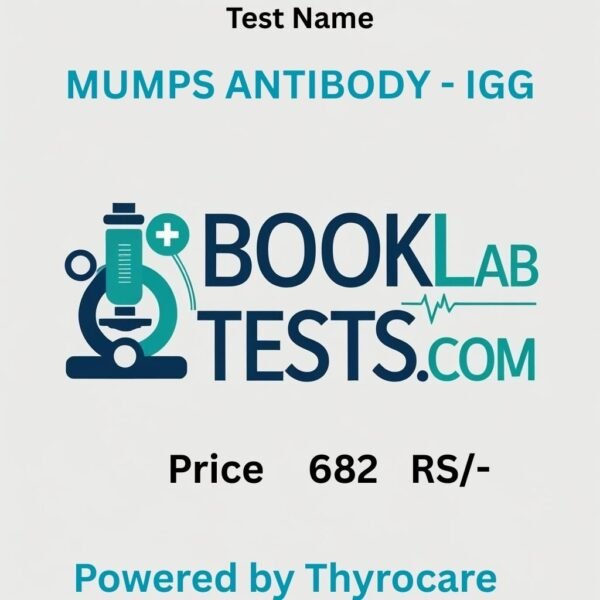 MUMPS ANTIBODY - IGG