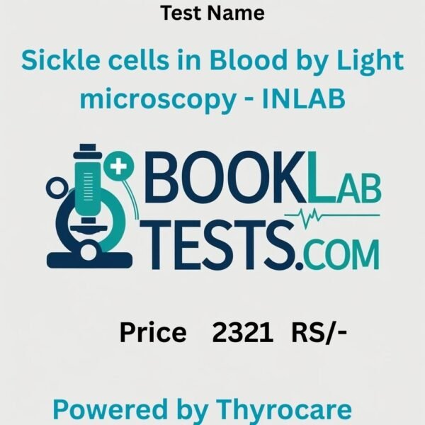 Sickle cells in Blood by Light microscopy - INLAB