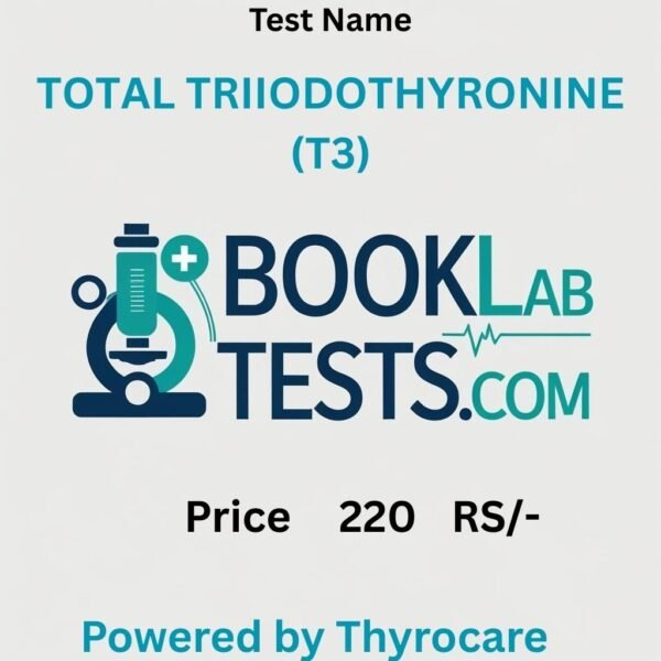 TOTAL TRIIODOTHYRONINE (T3)