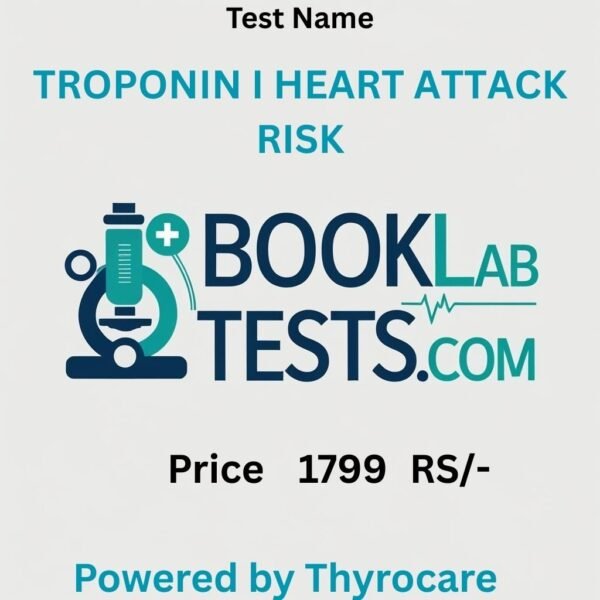 TROPONIN I HEART ATTACK RISK