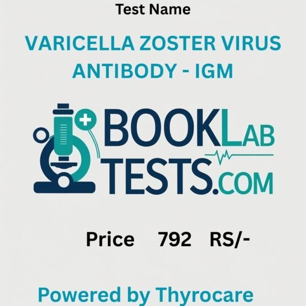 VARICELLA ZOSTER VIRUS ANTIBODY - IGM