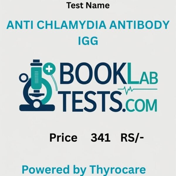 ANTI CHLAMYDIA ANTIBODY IGG