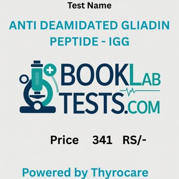 ANTI DEAMIDATED GLIADIN PEPTIDE - IGG