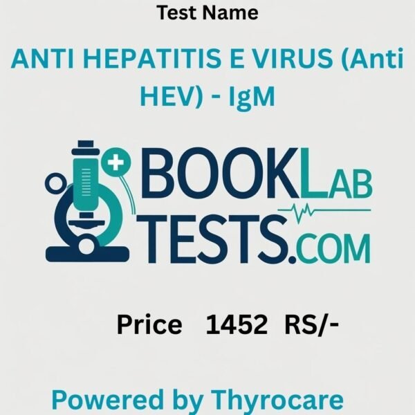 ANTI HEPATITIS E VIRUS (Anti HEV) - IgM
