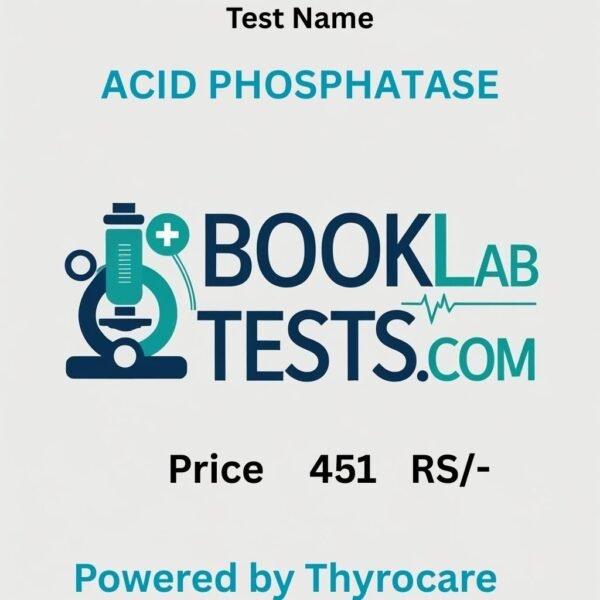 ACID PHOSPHATASE