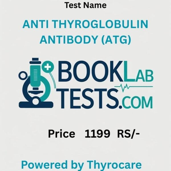 ANTI THYROGLOBULIN ANTIBODY (ATG)