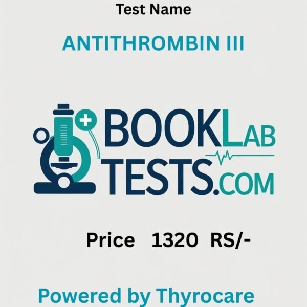 ANTITHROMBIN III