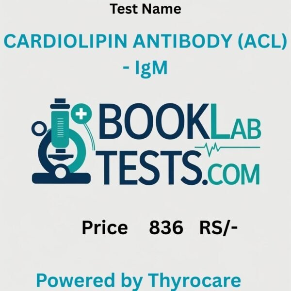 CARDIOLIPIN ANTIBODY (ACL) - IgM