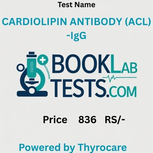 CARDIOLIPIN ANTIBODY (ACL) -IgG