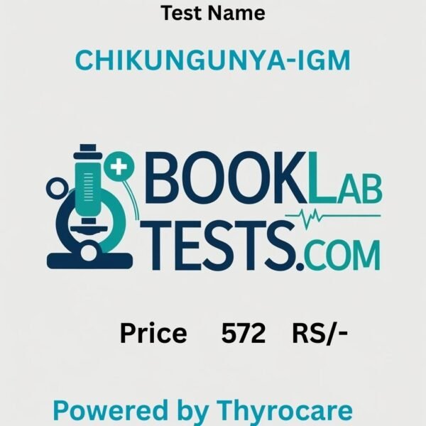 CHIKUNGUNYA-IGM