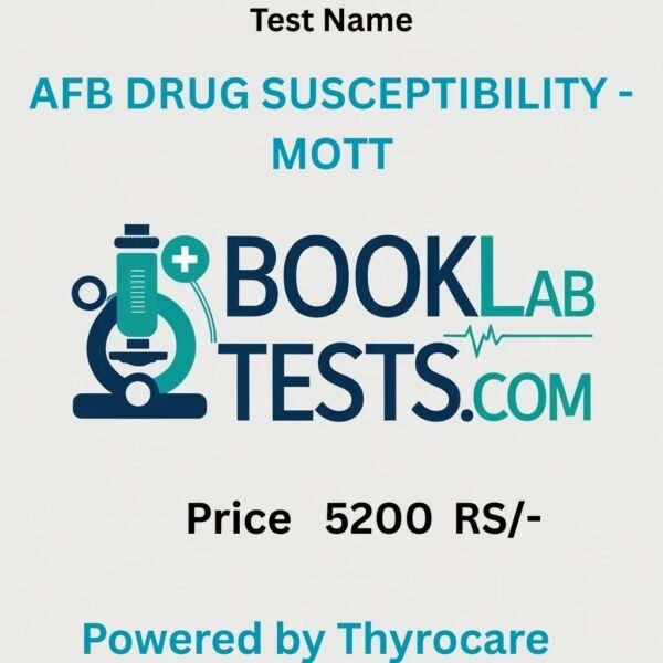 AFB DRUG SUSCEPTIBILITY - MOTT